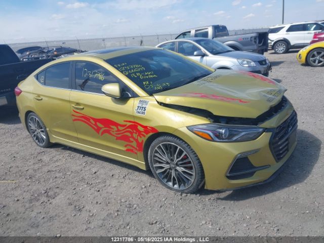 KMHD04LB0JU666299 Hyundai Elantra Sport
