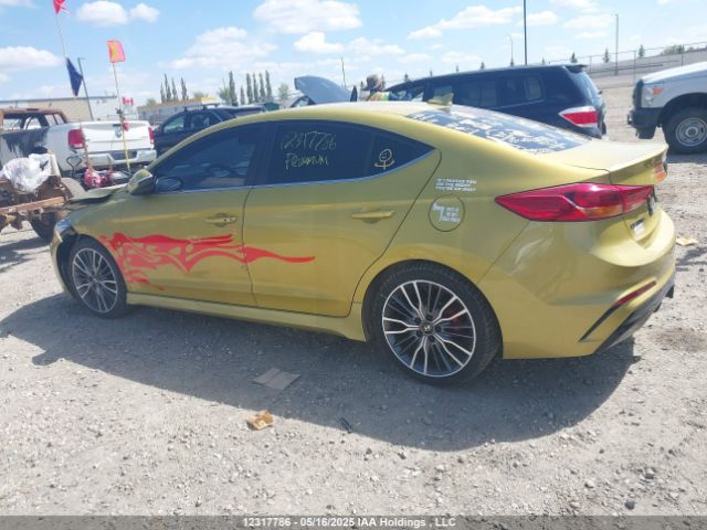 KMHD04LB0JU666299 Hyundai Elantra Sport