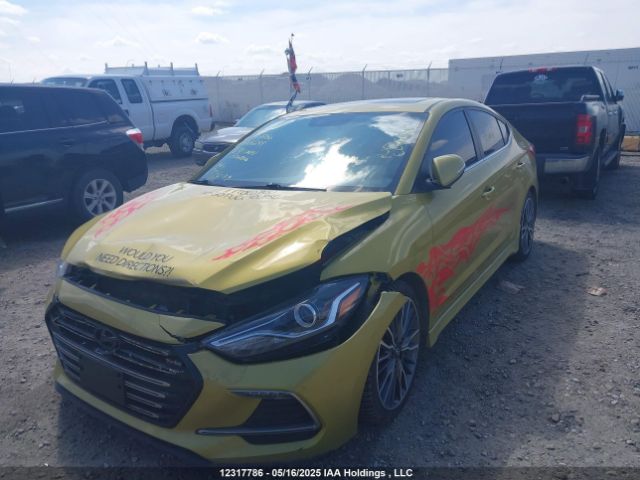 KMHD04LB0JU666299 Hyundai Elantra Sport
