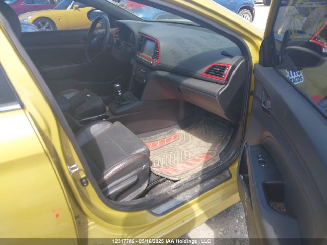 KMHD04LB0JU666299 Hyundai Elantra Sport