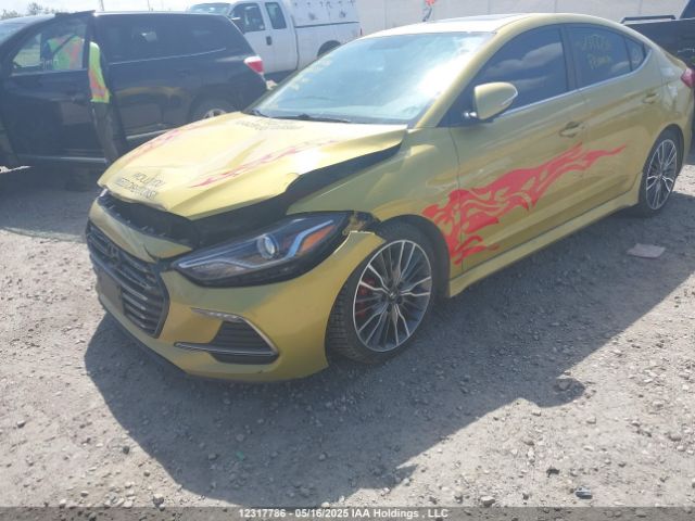 KMHD04LB0JU666299 Hyundai Elantra Sport