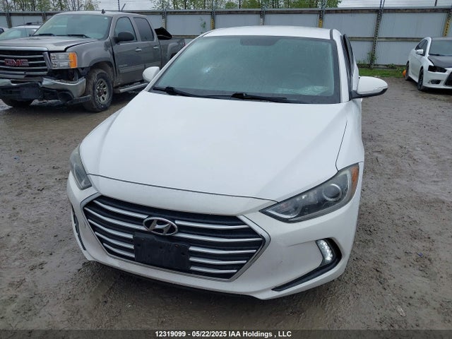 KMHD84LF1JU480850 Hyundai mpi nu