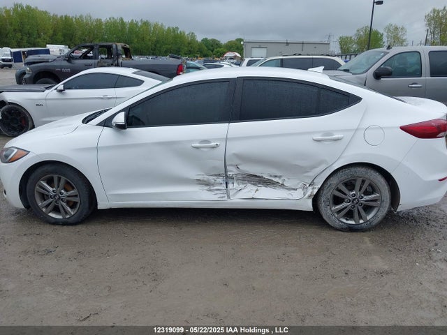 KMHD84LF1JU480850 Hyundai mpi nu
