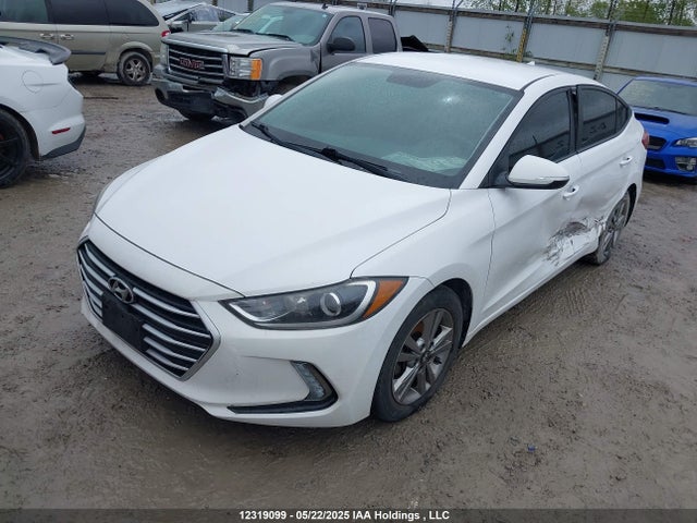KMHD84LF1JU480850 Hyundai mpi nu