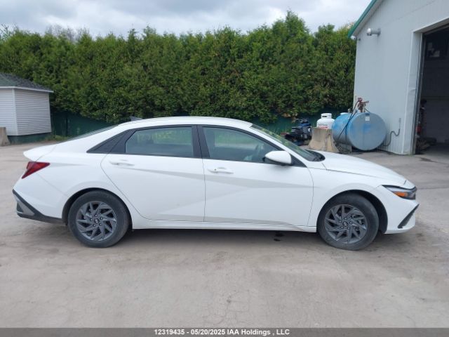 KMHLM4DG8RU714959 Hyundai mpi nu pe