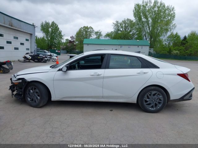 KMHLM4DG8RU714959 Hyundai mpi nu pe