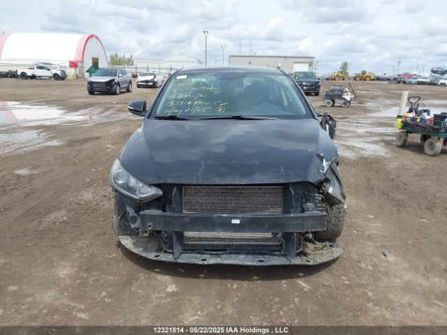 KMHD84LF0JU633072 Hyundai ELANTRA GL