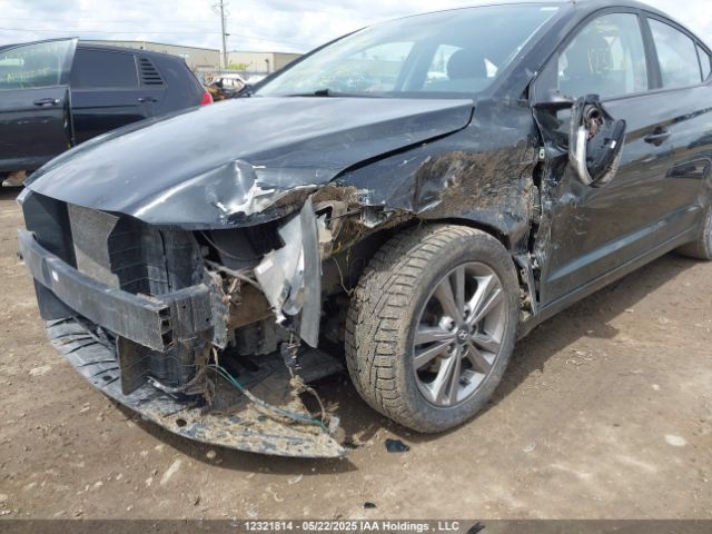 KMHD84LF0JU633072 Hyundai ELANTRA GL