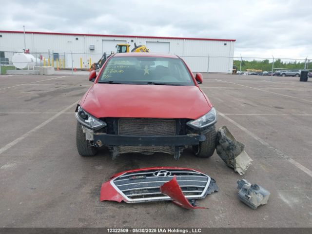 KMHD84LFXJU539801 Hyundai ELANTRA GL