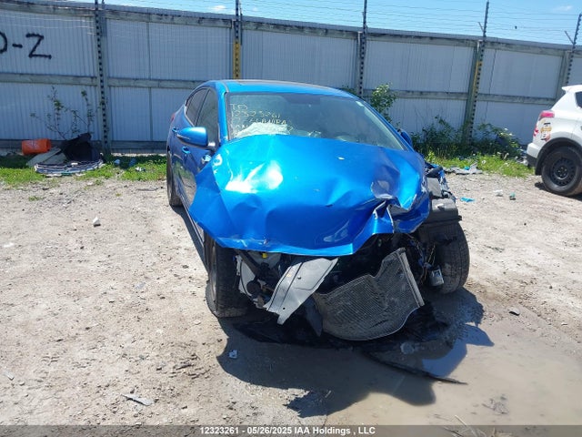KMHD84LF9HU240407 Hyundai 2017
