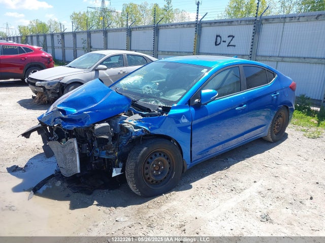 KMHD84LF9HU240407 Hyundai 2017