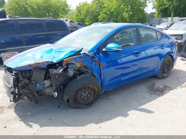 KMHD84LF7JU551842 Hyundai mpi nu