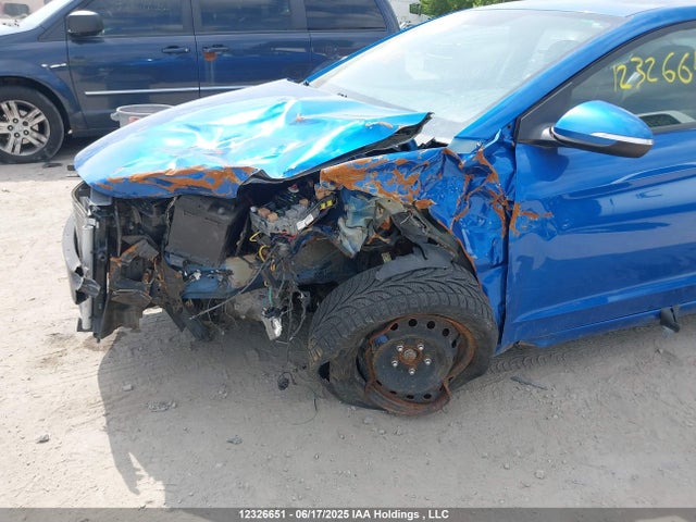 KMHD84LF7JU551842 Hyundai mpi nu