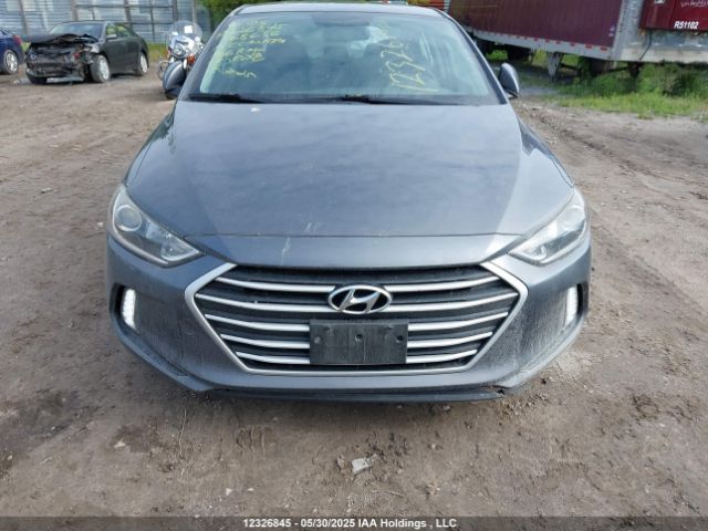 KMHD84LF7JU568656 Hyundai mpi nu