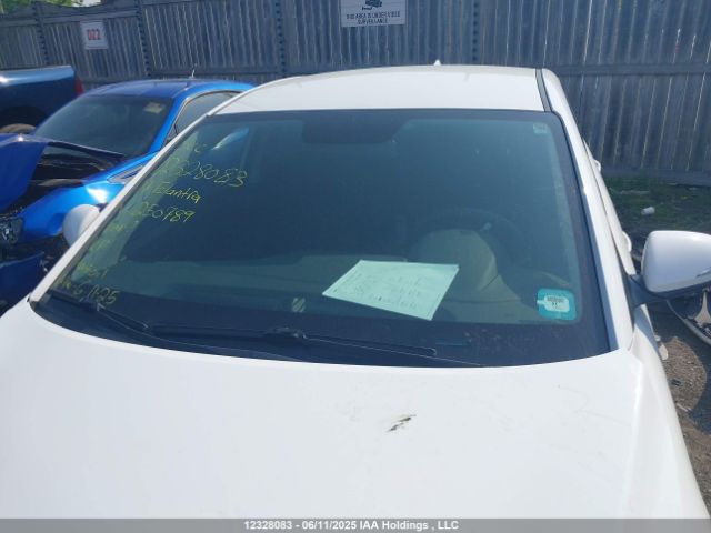 KMHD84LF0HU250789 Hyundai ELANTRA GL