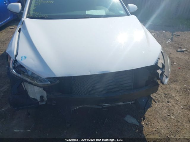 KMHD84LF0HU250789 Hyundai ELANTRA GL