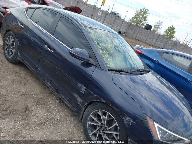 KMHD84LFXLU100374 Hyundai mpi nu