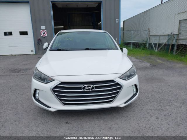 KMHD84LFXHU140316 Hyundai 2017
