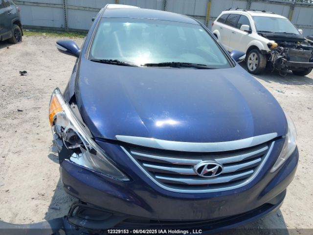5NPEB4AC2EH863666 Hyundai Sonata