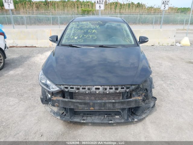 KMHD84LF4JU467395 Hyundai Elantra Sel/value/limited