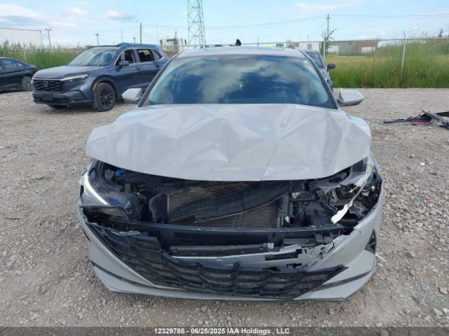 KMHLM4AG6PU578171 Hyundai mpi nu pe