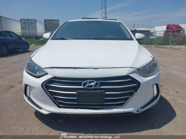 KMHD84LF1HU186360 Hyundai ELANTRA GL