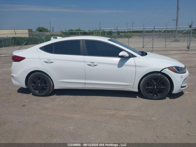 KMHD84LF1HU186360 Hyundai ELANTRA GL