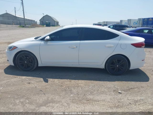 KMHD84LF1HU186360 Hyundai ELANTRA GL