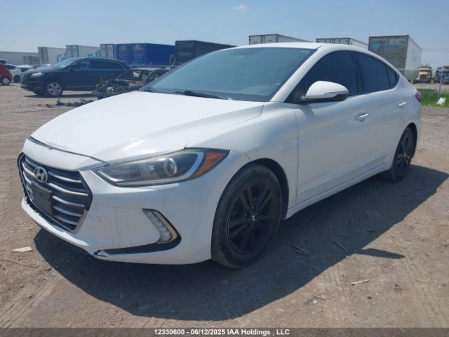KMHD84LF1HU186360 Hyundai ELANTRA GL