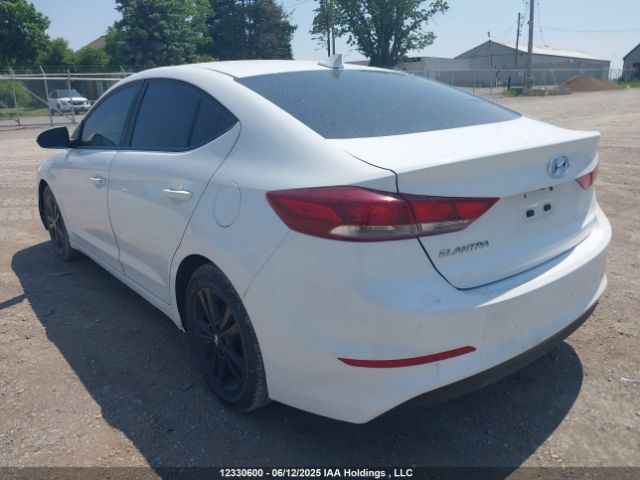 KMHD84LF1HU186360 Hyundai ELANTRA GL