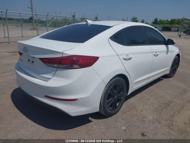 KMHD84LF1HU186360 Hyundai ELANTRA GL
