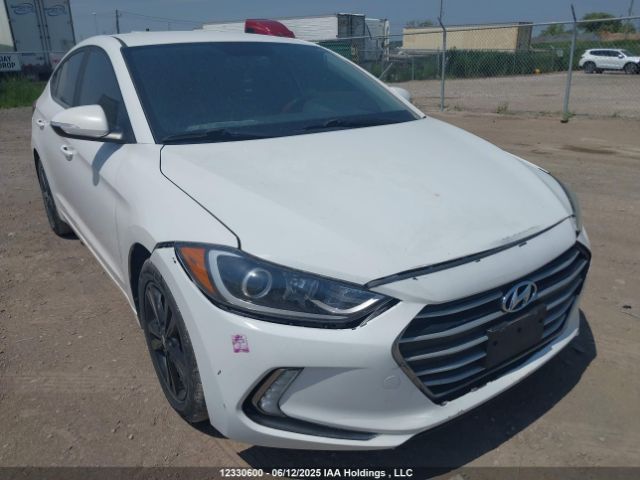 KMHD84LF1HU186360 Hyundai ELANTRA GL