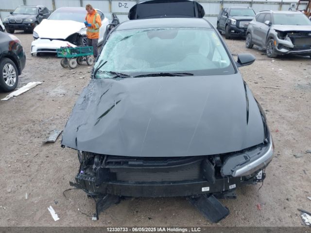 KMHLM4DG5SU993003 Hyundai mpi nu pe