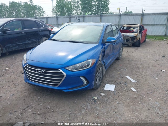 KMHD84LF3JU634121 Hyundai mpi nu