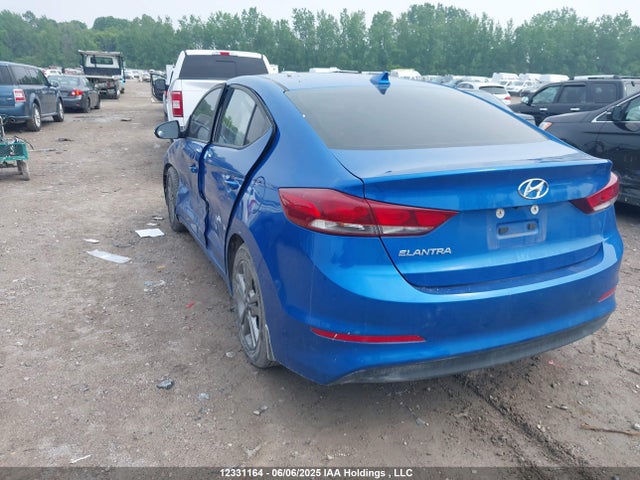 KMHD84LF3JU634121 Hyundai mpi nu
