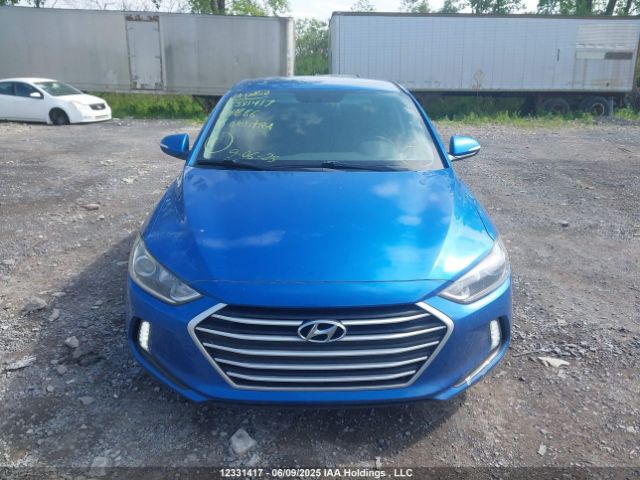 KMHD84LF6JU641886 Hyundai Elantra Sel/value/limited