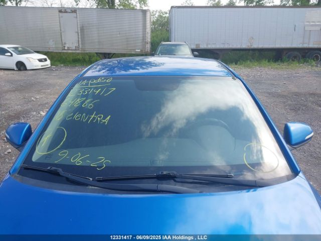 KMHD84LF6JU641886 Hyundai Elantra Sel/value/limited