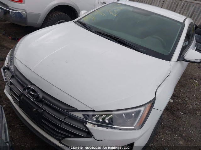 KMHD84LF9LU053077 Hyundai mpi nu