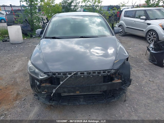 KMHD84LF5JU620074 Hyundai mpi nu