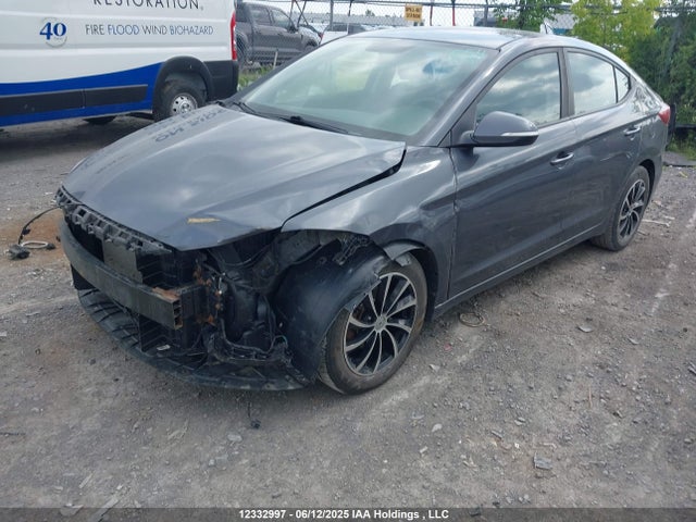 KMHD84LF5JU620074 Hyundai mpi nu