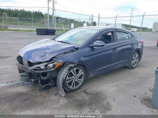 KMHD84LF4HU295962 Hyundai 2017