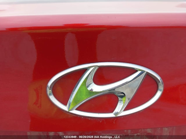 KMHD84LF6HU322885 Hyundai 2017
