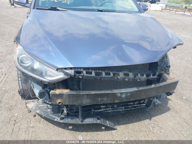 KMHD84LF8HU416945 Hyundai 2017