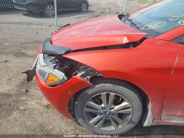 KMHD84LF4HU094496 Hyundai 2017