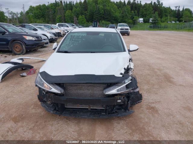 KMHD74LF6LU970609 Hyundai mpi nu