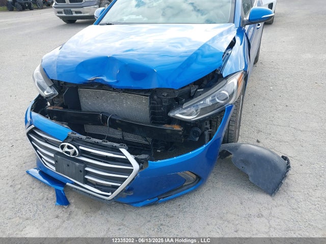 KMHD84LF6JU692546 Hyundai mpi nu
