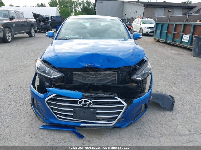 KMHD84LF6JU692546 Hyundai mpi nu