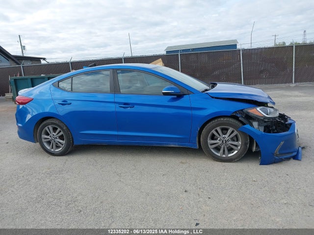 KMHD84LF6JU692546 Hyundai mpi nu
