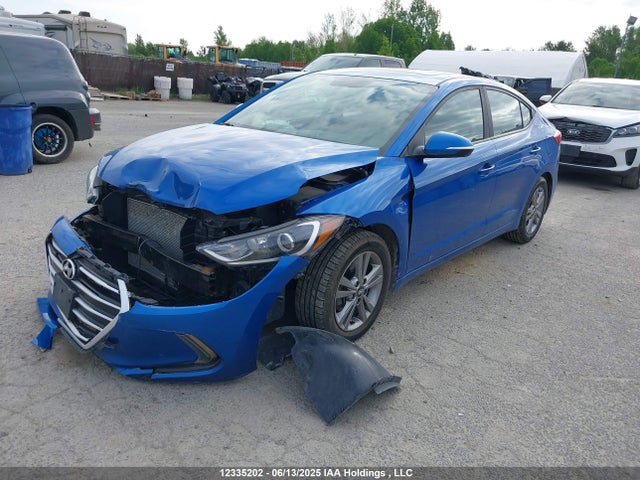 KMHD84LF6JU692546 Hyundai mpi nu