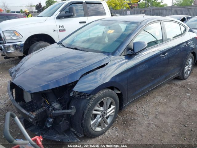 KMHD84LF0LU109648 Hyundai mpi nu